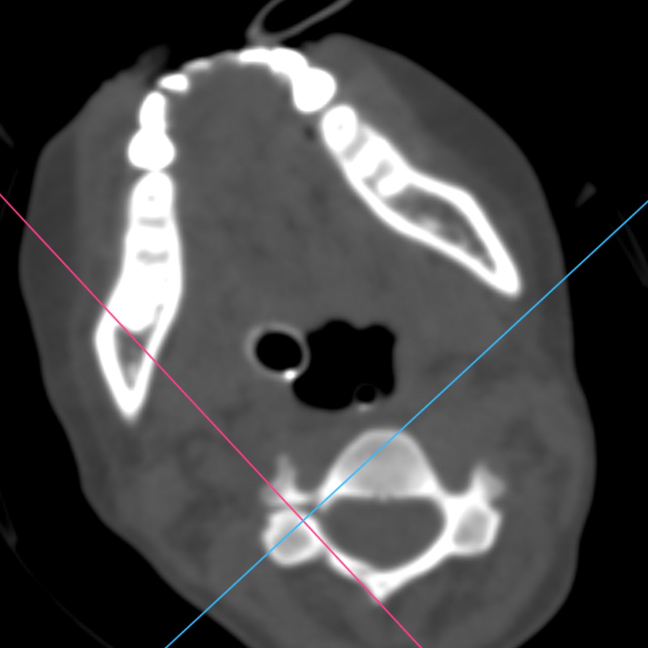 David Tafur Muñoz-2172