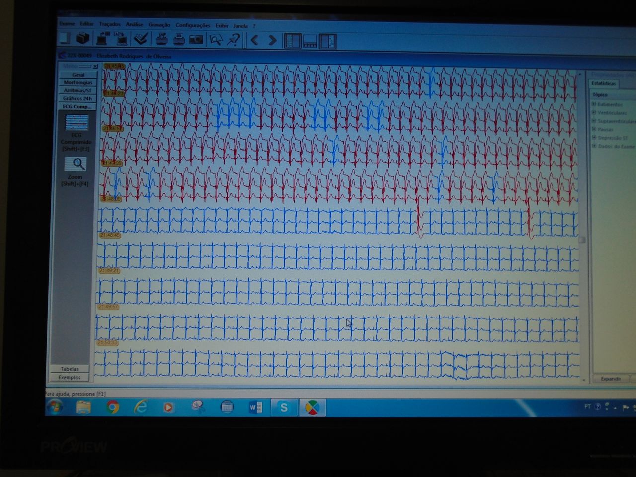 Haroldo Gomes Nascimento-6