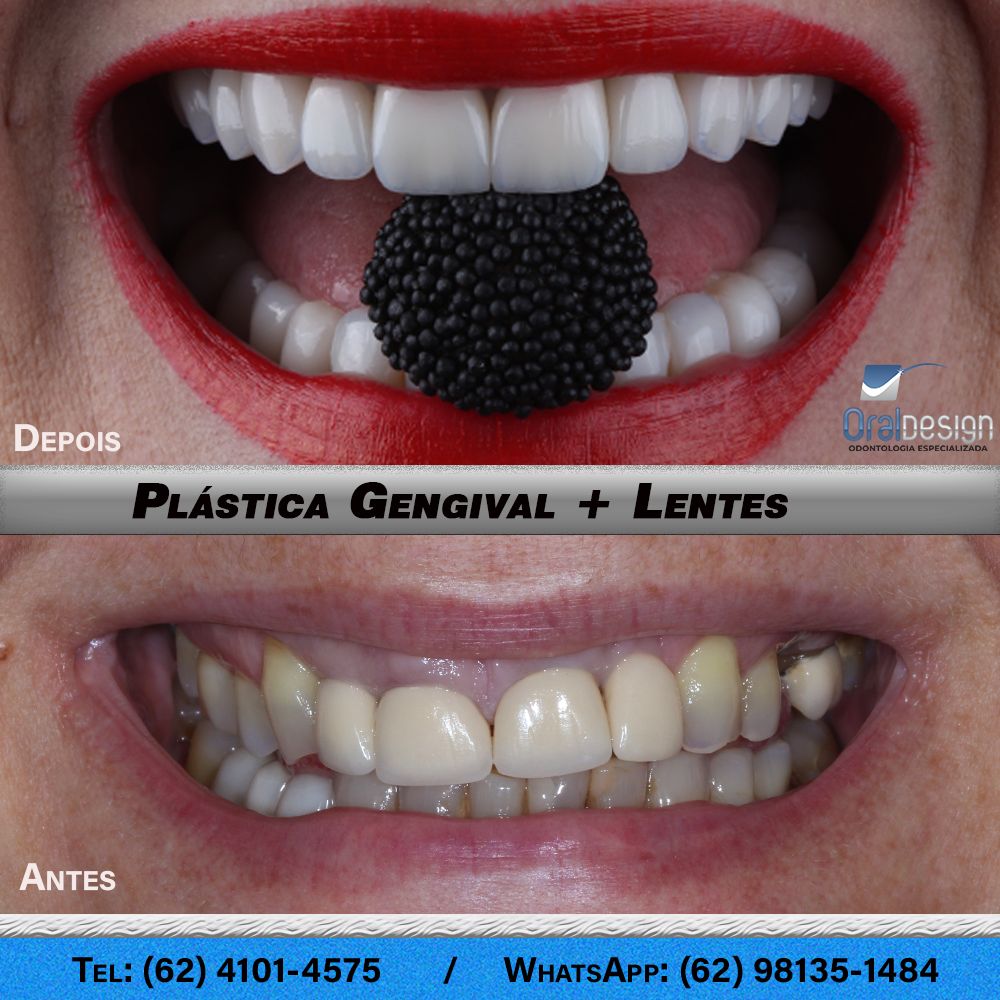 Danilo Monteiro Rezende Pereira-9