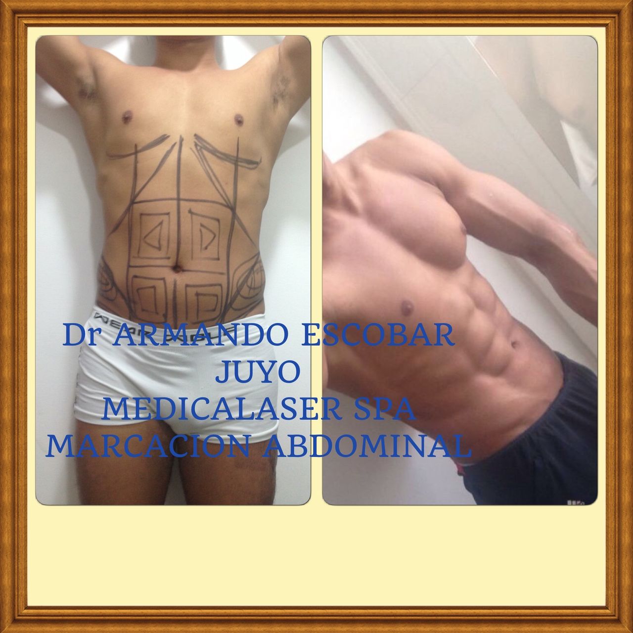 Armando Escobar Juyo-44