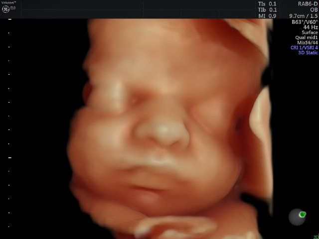 Raul Javier Banderas Pumarino-27