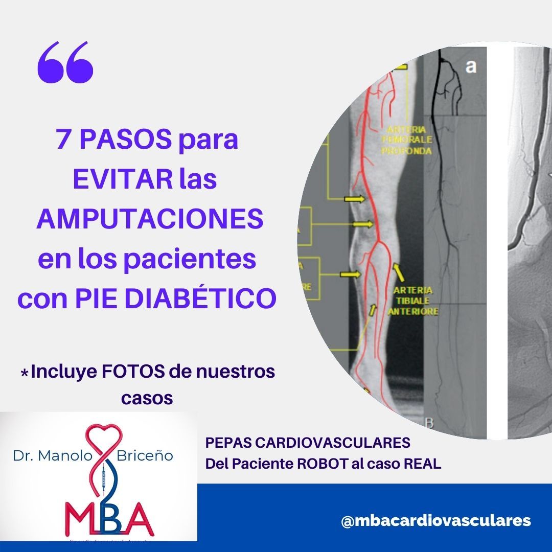 Manolo Briceño Alvarado-11