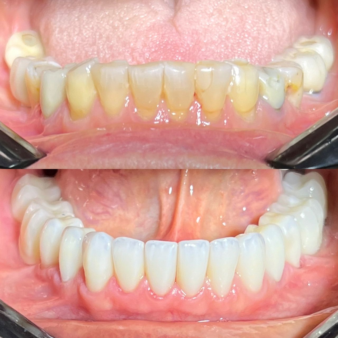 Caroline Benedeti-12