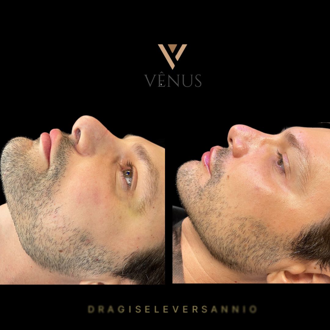 Gisele De Carvalho Versannio-22