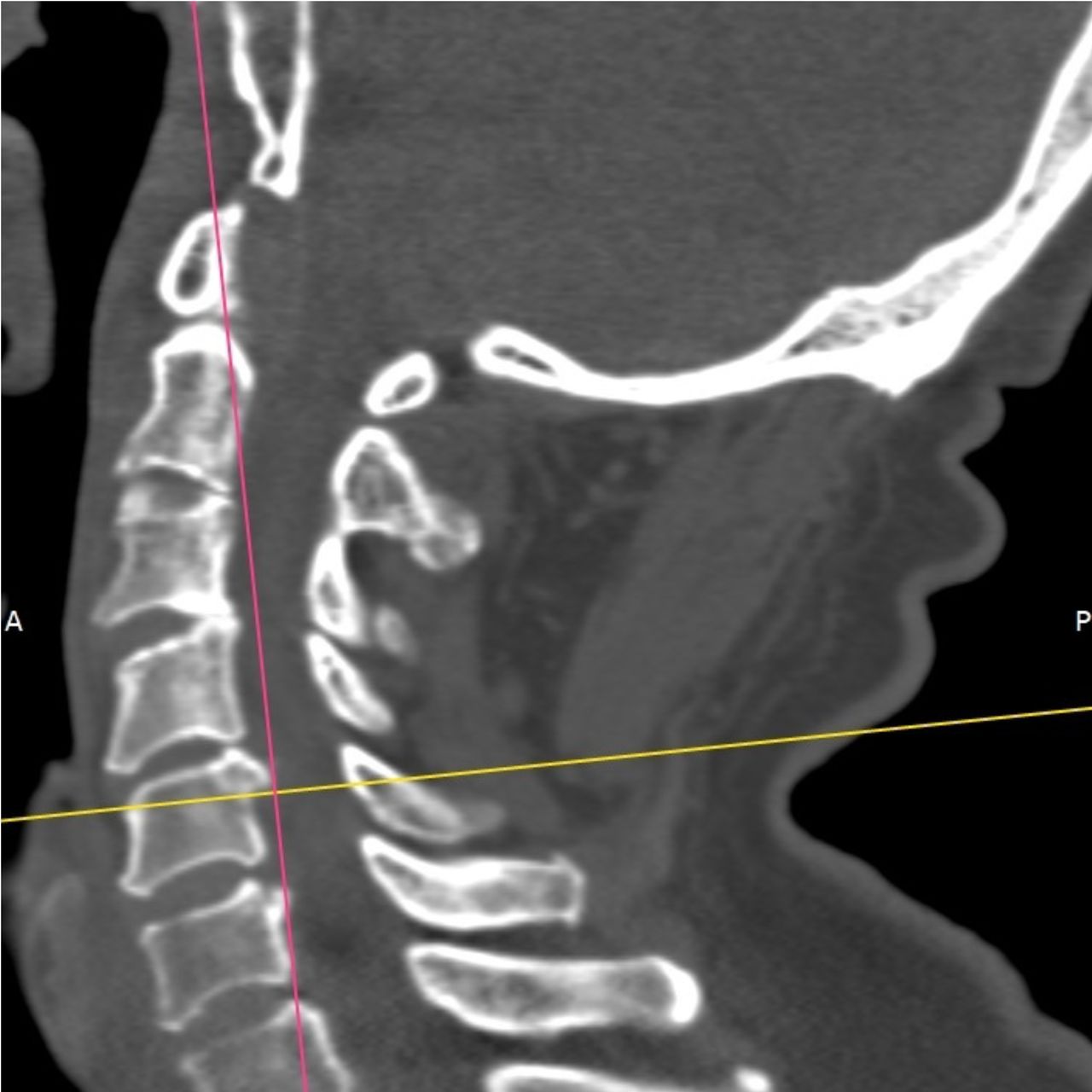 David Tafur Muñoz-1566