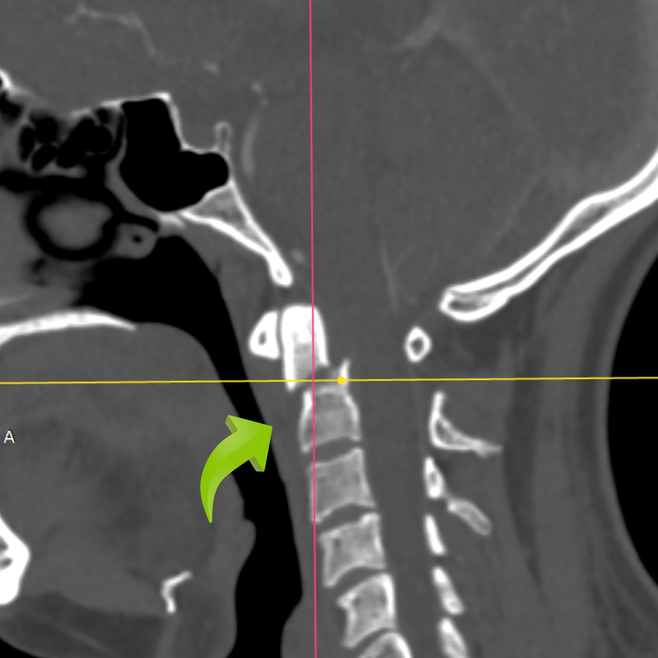 David Tafur Muñoz-2103