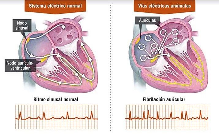 Edelmiro Chelle Chetrit-17