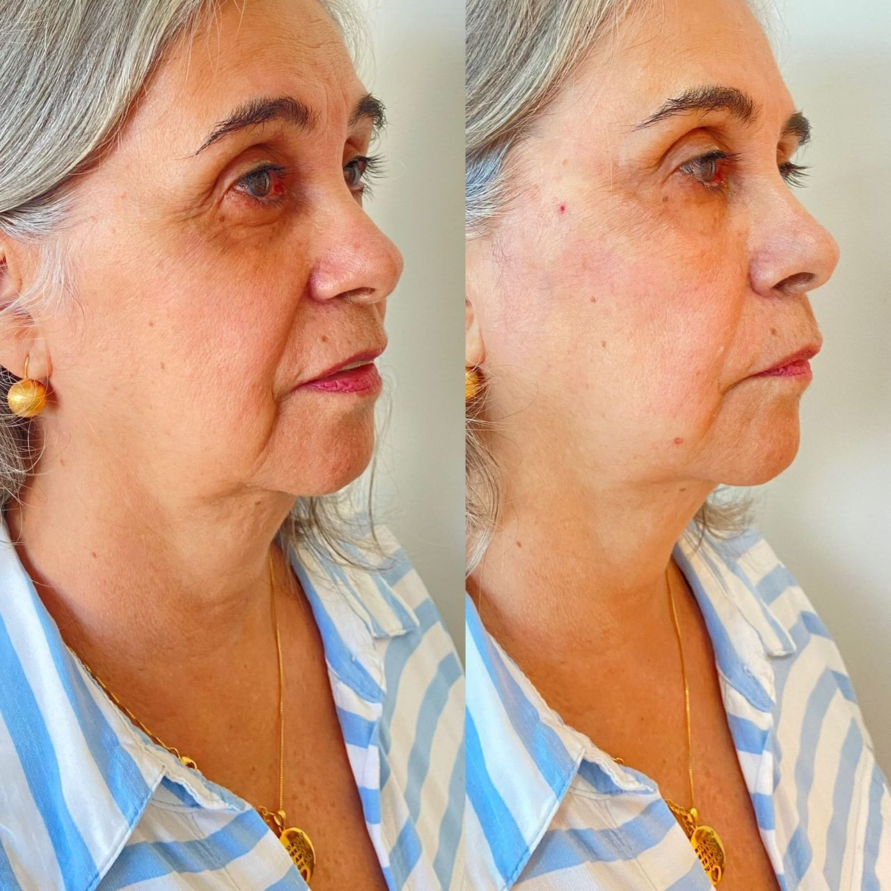 Telma Viana Martins-18