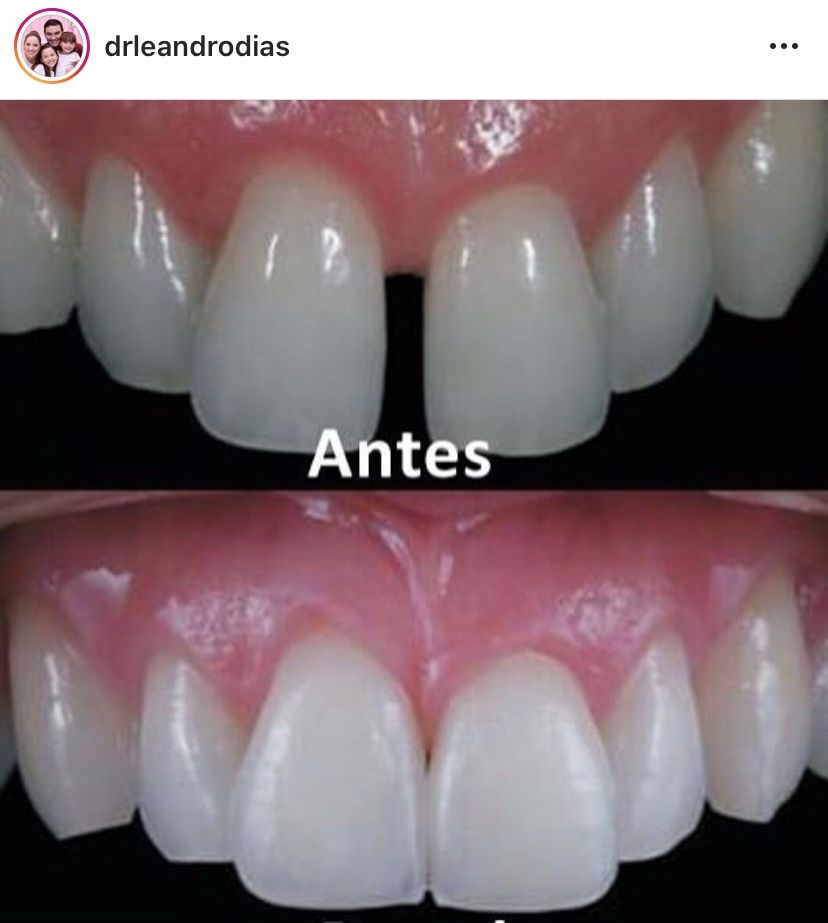 Leandro Ponte Dias-24