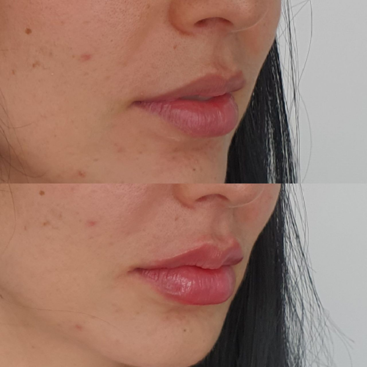 Juan Guillermo Bretón Franco-25