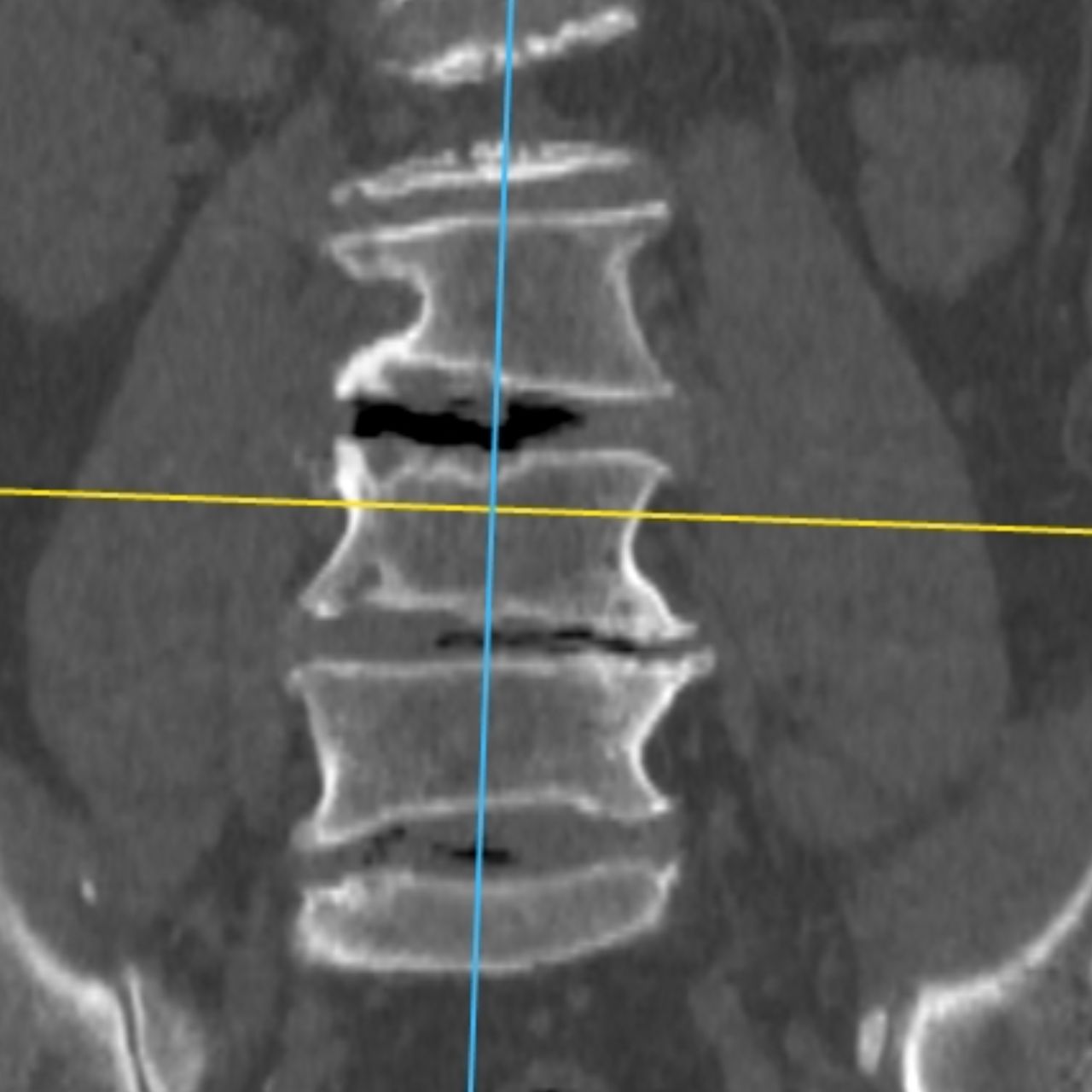 David Tafur Muñoz-1731