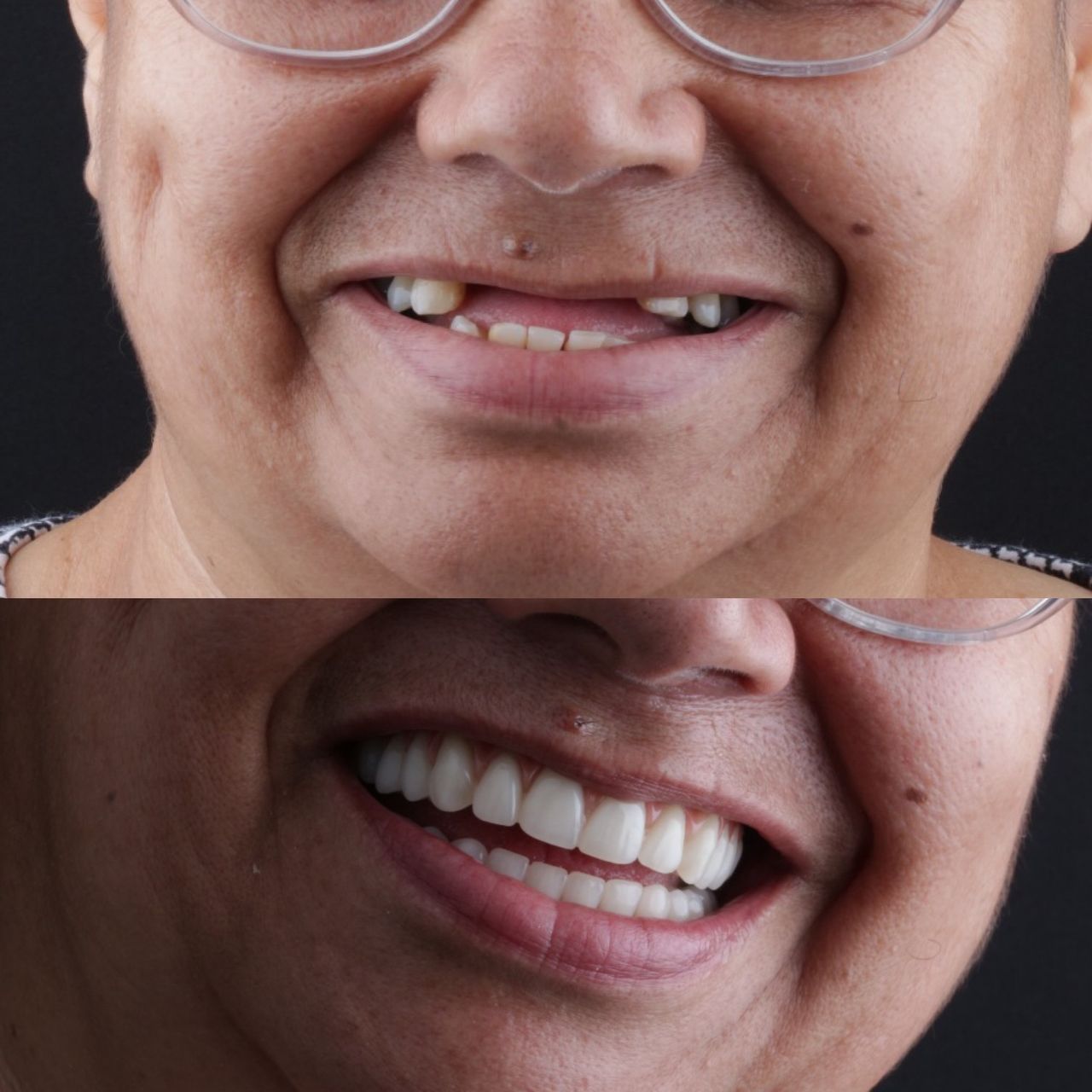 Guilherme  Carvalho-11