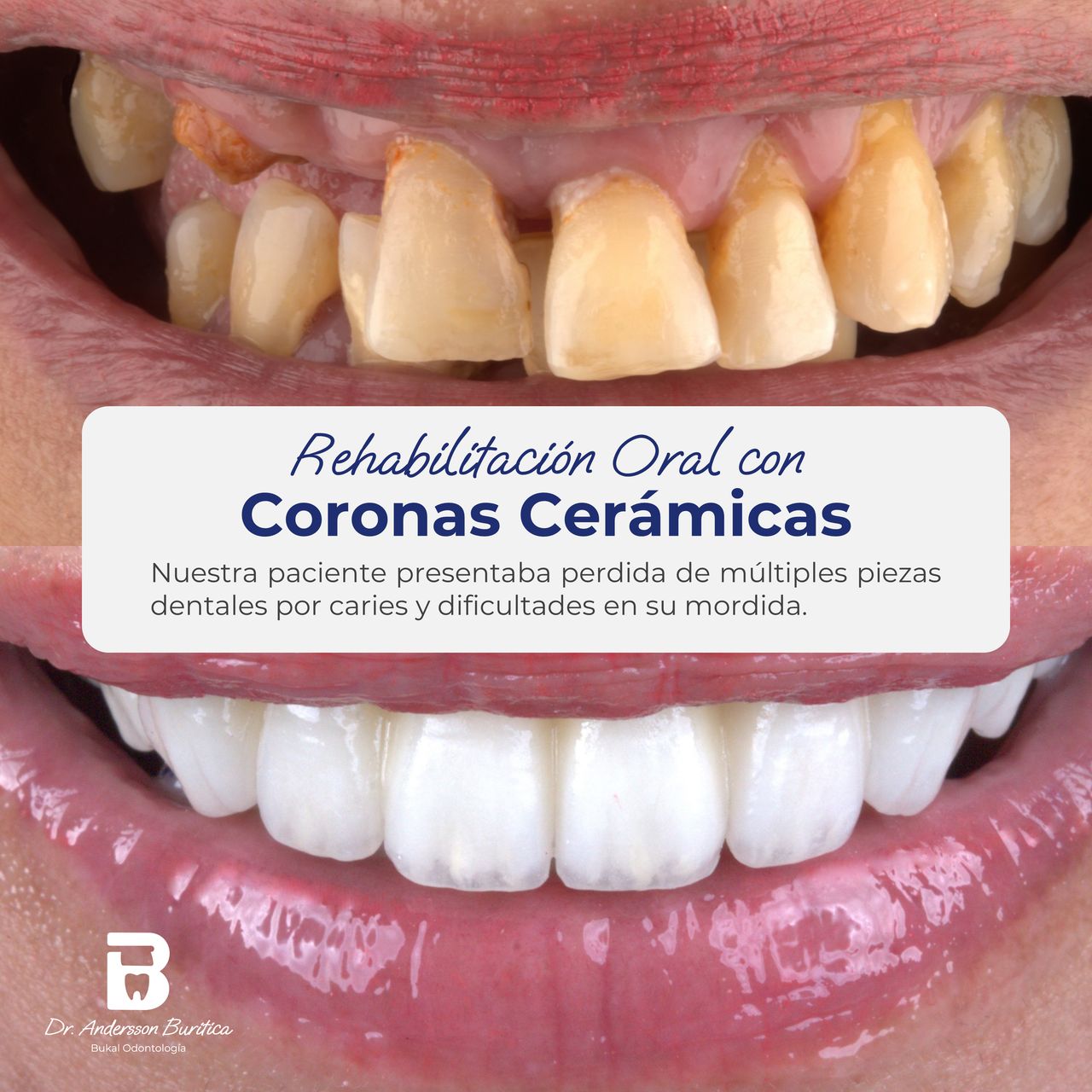 Andersson Buritica-7