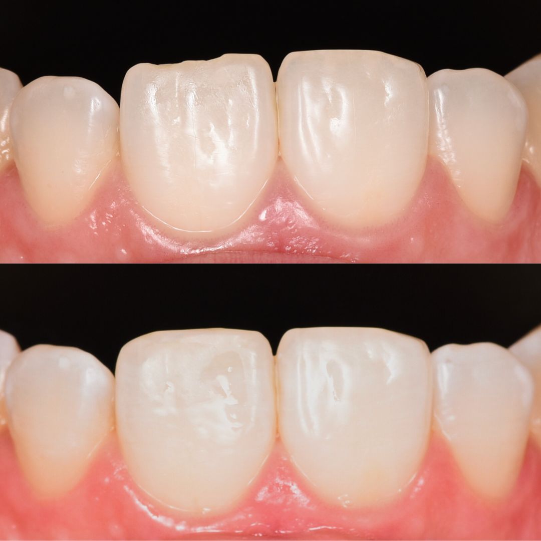 Andrés Verdugo Bolumburu-9