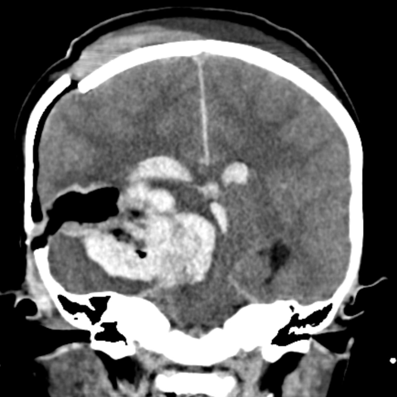 David Tafur Muñoz-1743