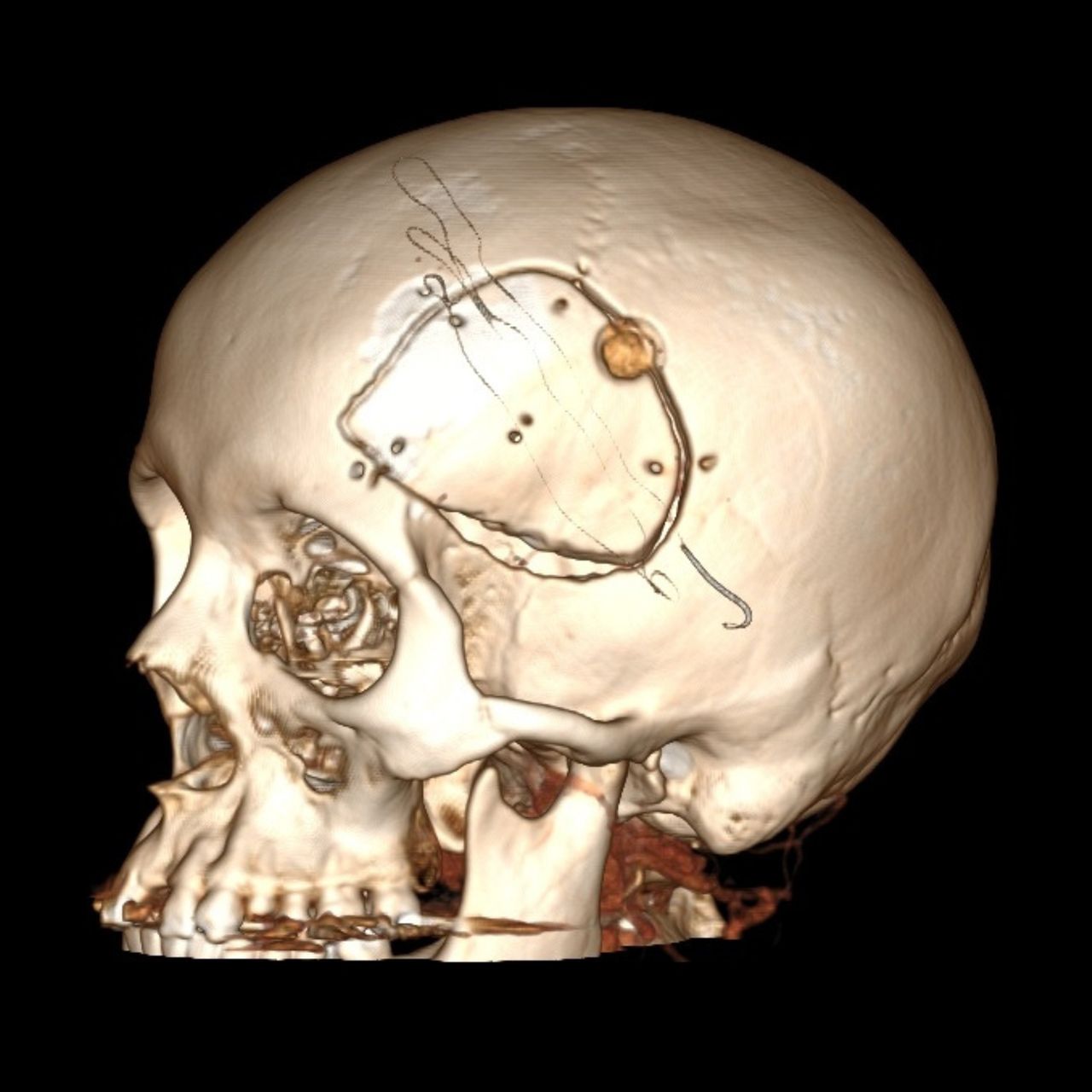 David Tafur Muñoz-1270