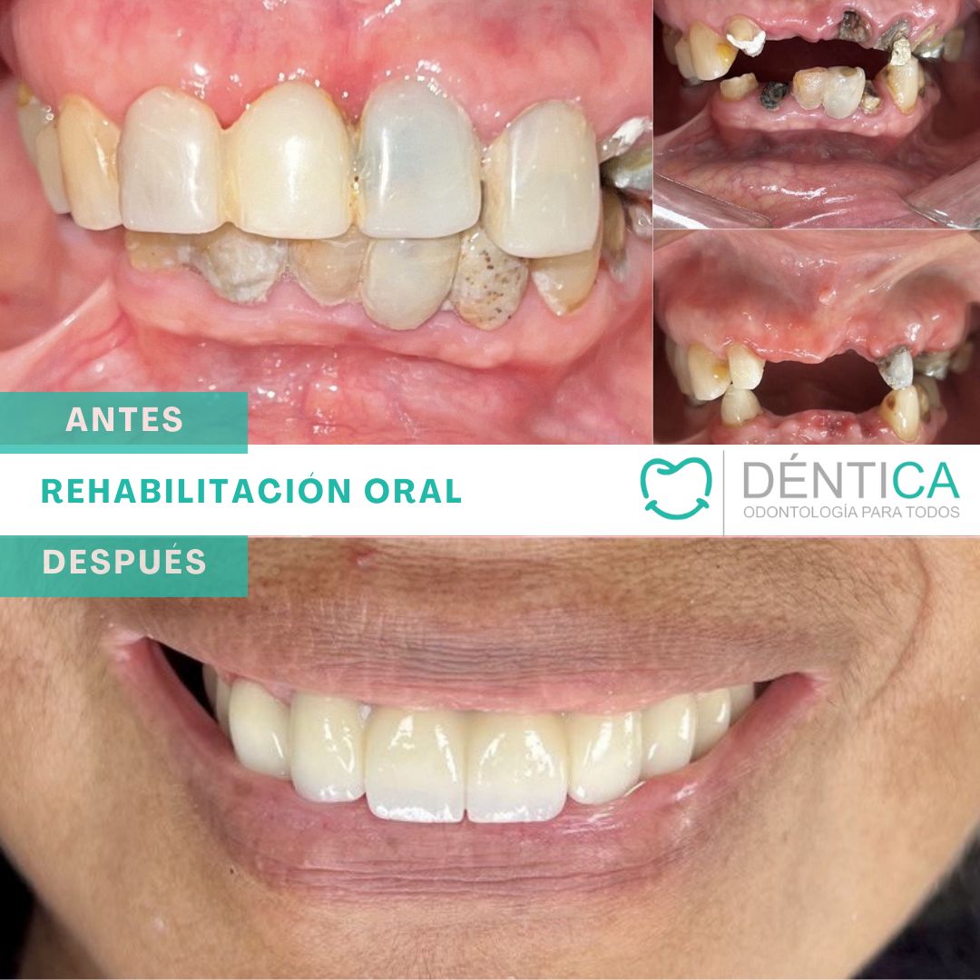 Estefani Canches Caballero-15