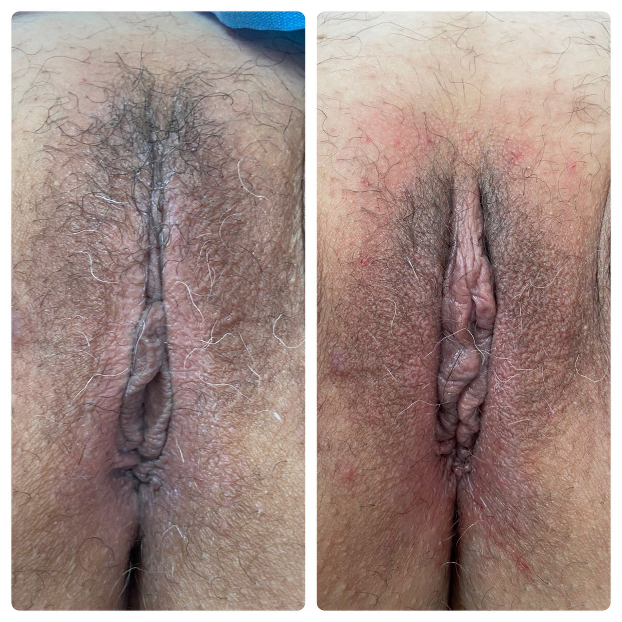 Mario Santiago Mesa Espinel-9