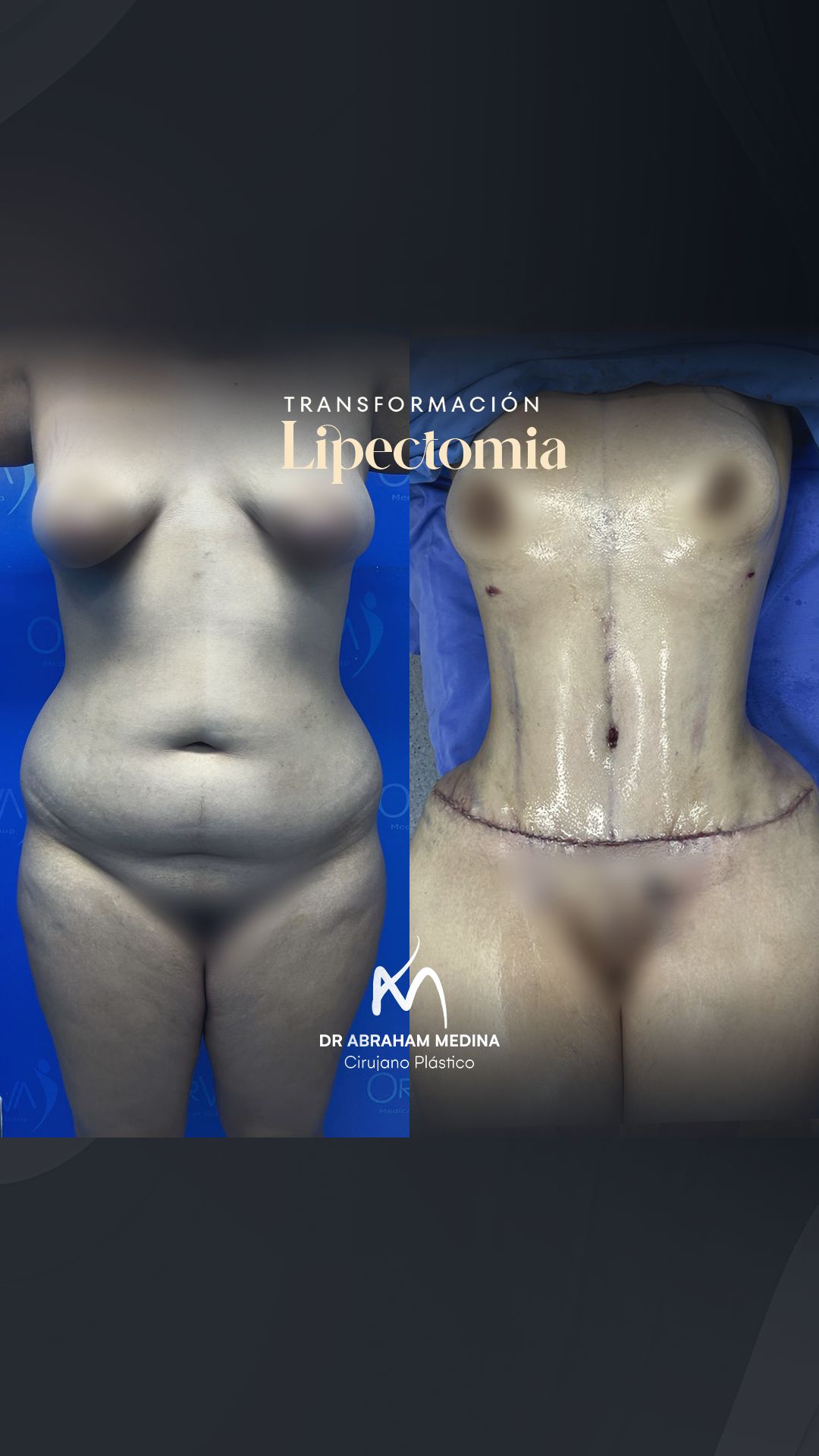 Jose Abraham Medina Y Navarro-11