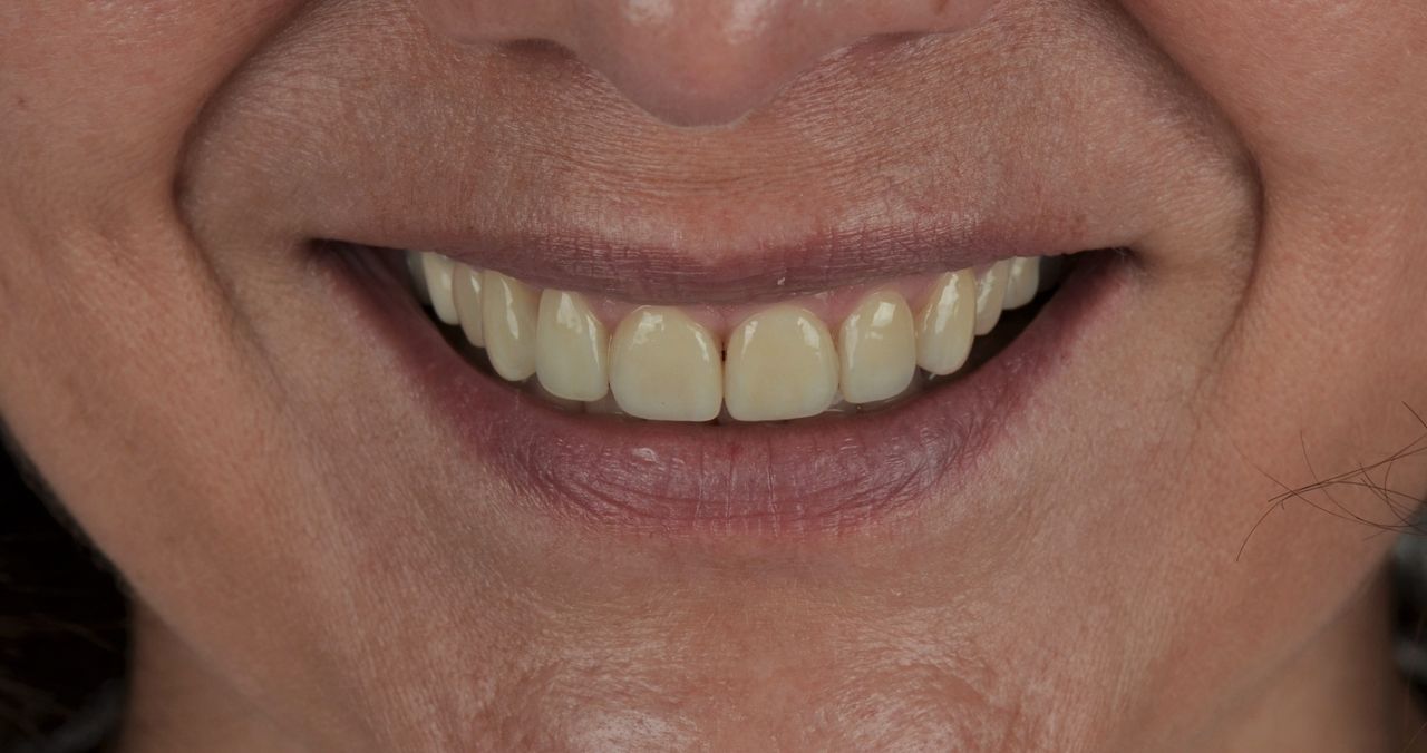 Luciano Varas Salinas-38