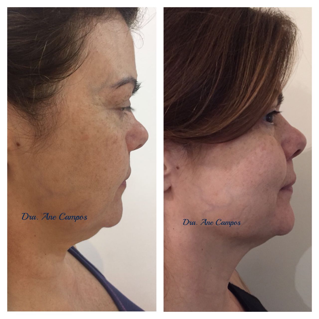 Ane Campos-3