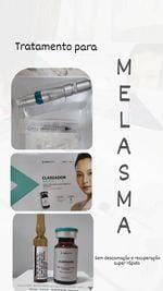 Ana Paula Andreolla-6