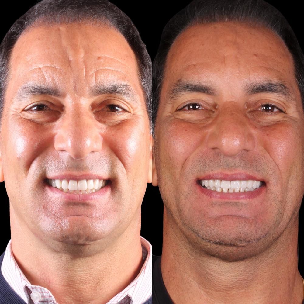 Caroline Benedeti-16