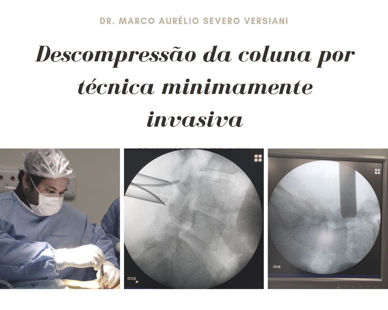 Marco Aurélio Severo Da Silva Versiani-64