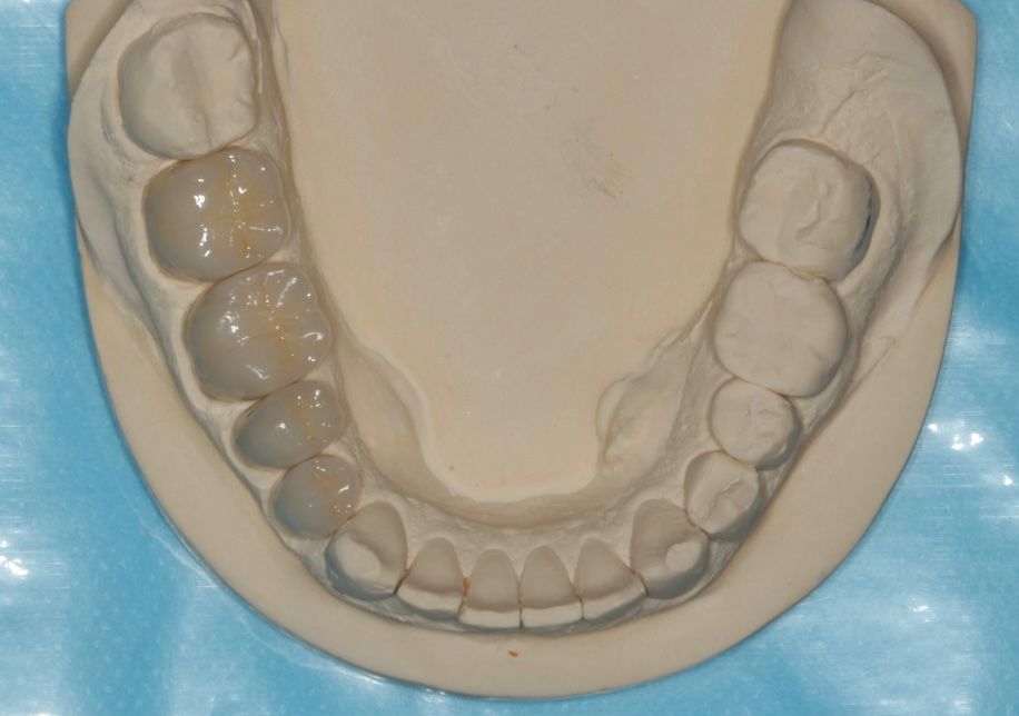 Antônio Alegria Do Nascimento-8