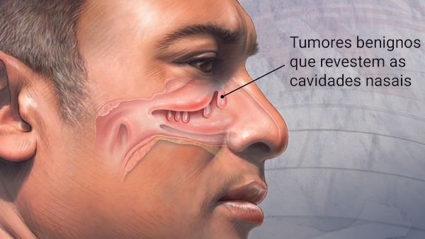 Antonio Carlos Biel-16