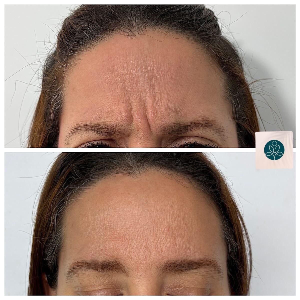 Zulay Angelica Zabala Suarez-20