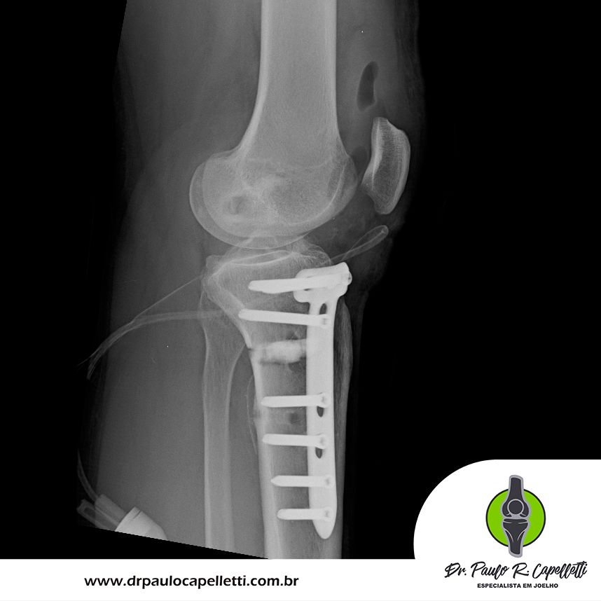 Paulo Roberto Capelletti-6