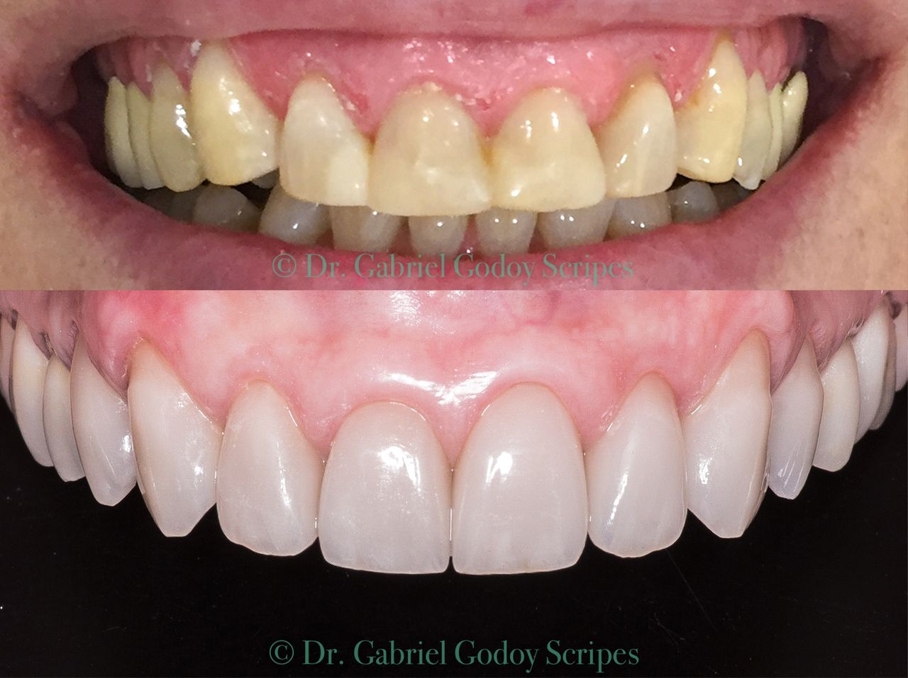 Gabriel Godoy Scripes-50