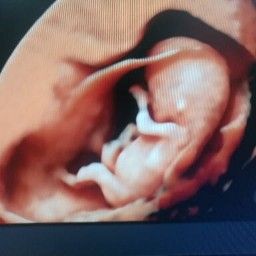 Diego Giovanni Rubiano Zarate-7