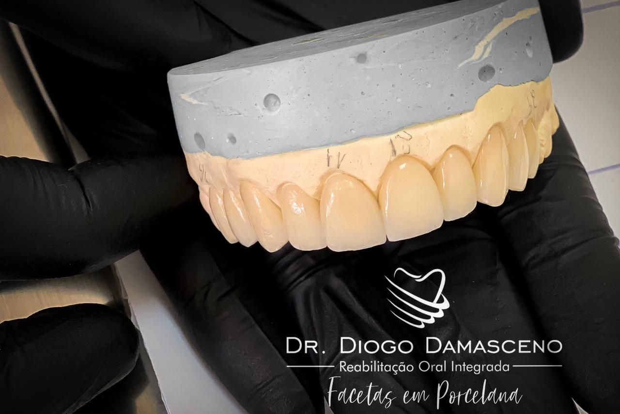 Diogo Damasceno-29