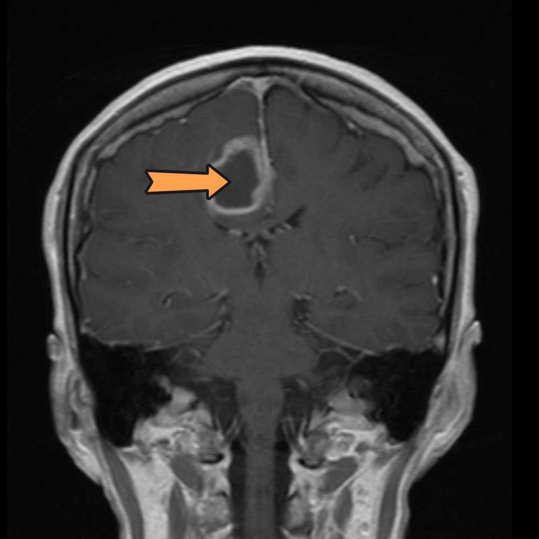 David Tafur Muñoz-2325