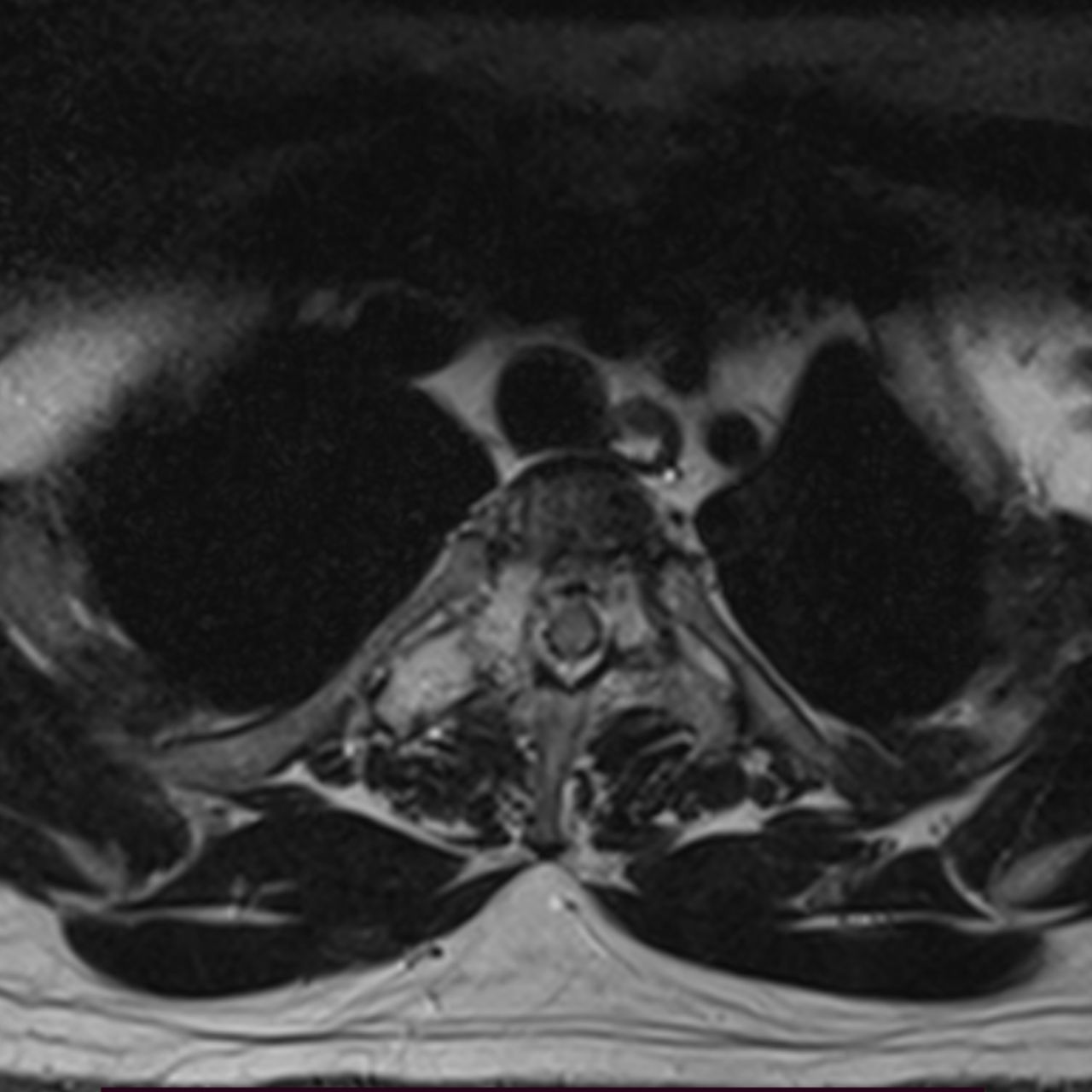 David Tafur Muñoz-2484