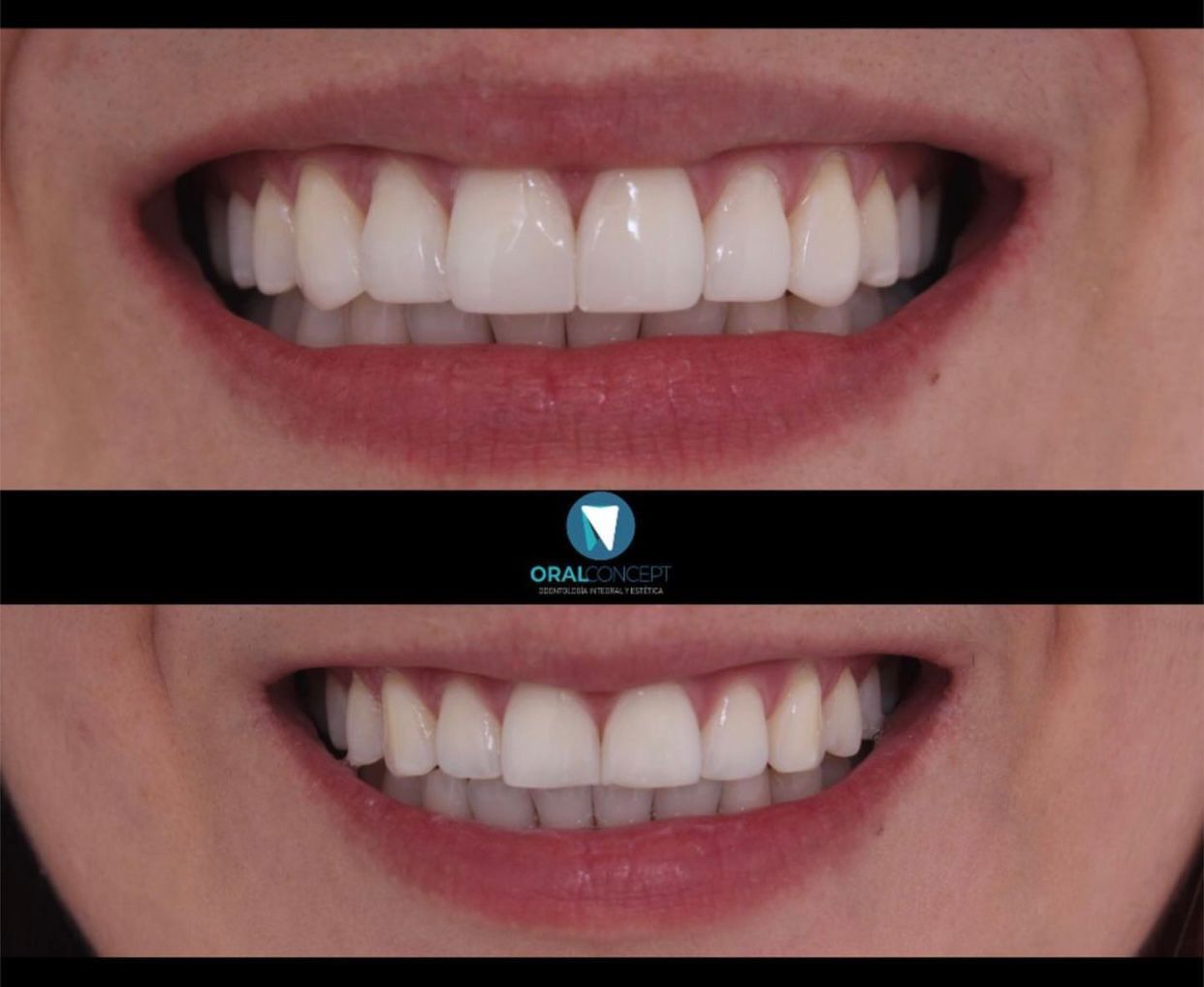 Andrés Mauricio Yepes Vargas-5