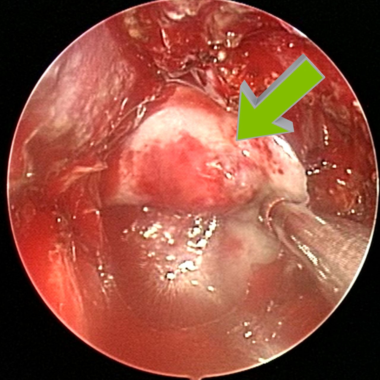 David Tafur Muñoz-1317