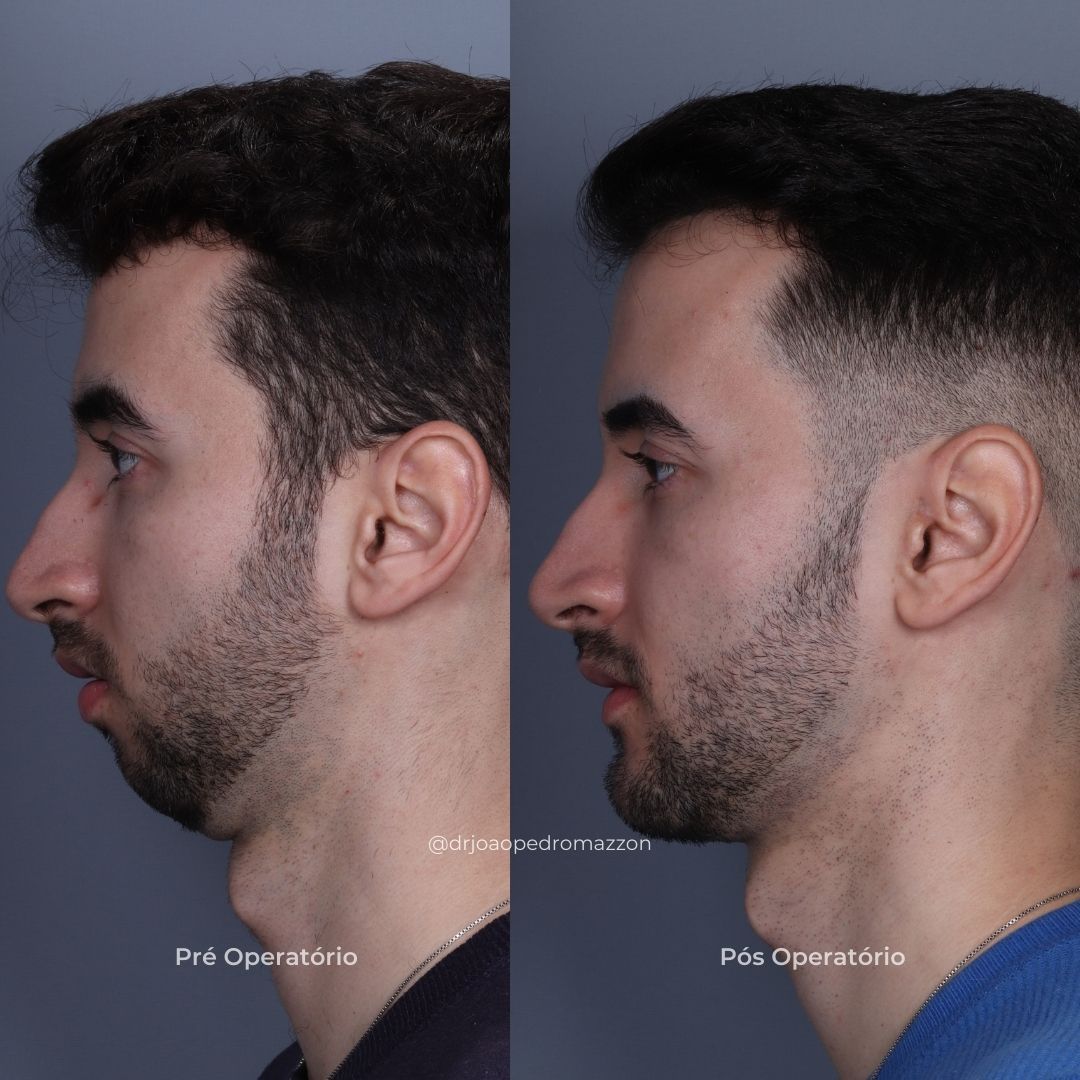 João Pedro Paulino Mazzon-69