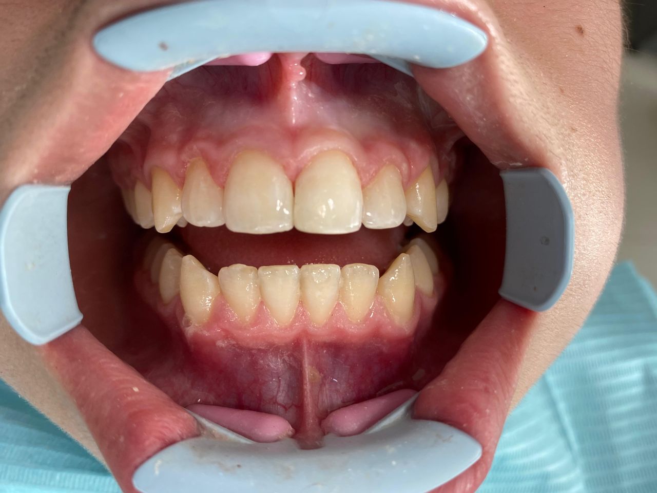 Francisco Bahamonde-3