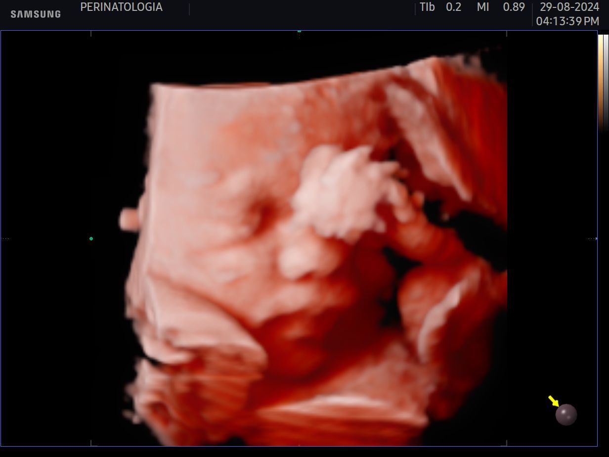 Karina Bastidas Ibarra-4