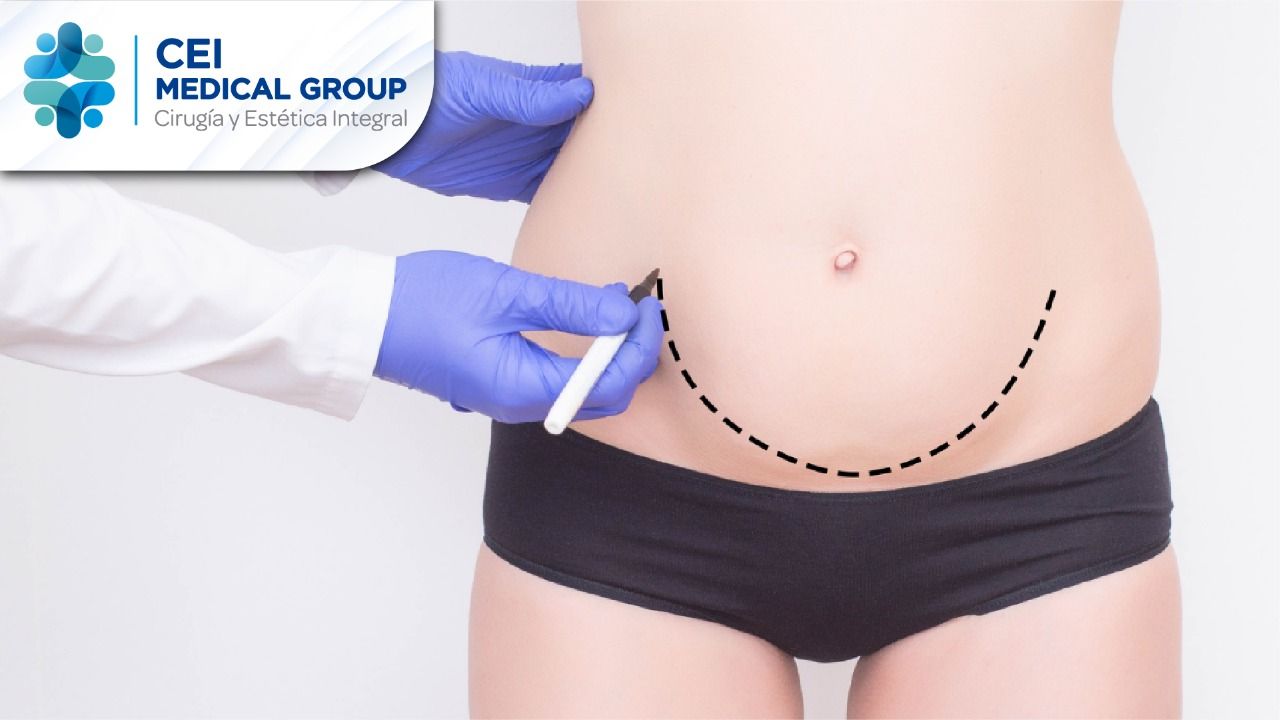 Javier Velasquez Bedoya-5