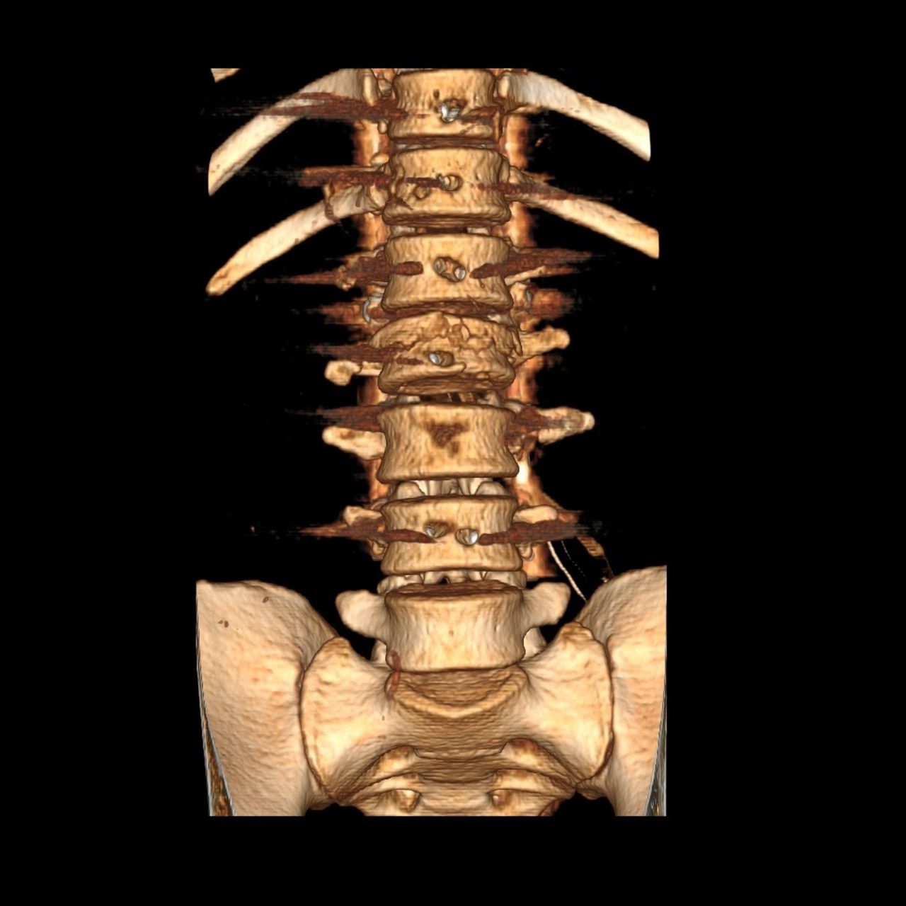 David Tafur Muñoz-1312