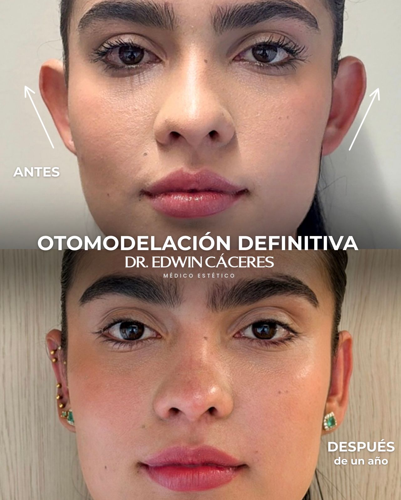 Edwin Cáceres Melendez-0