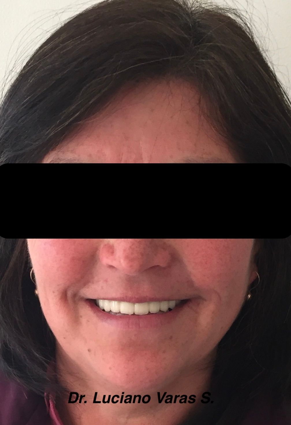 Luciano Varas Salinas-5