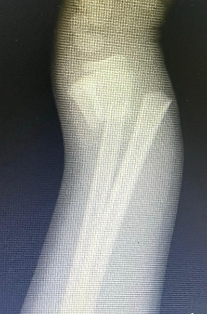 Jônatas Laurindo Giacomini-22