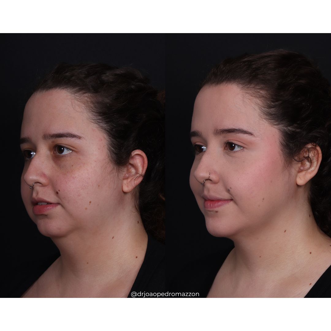 João Pedro Paulino Mazzon-30