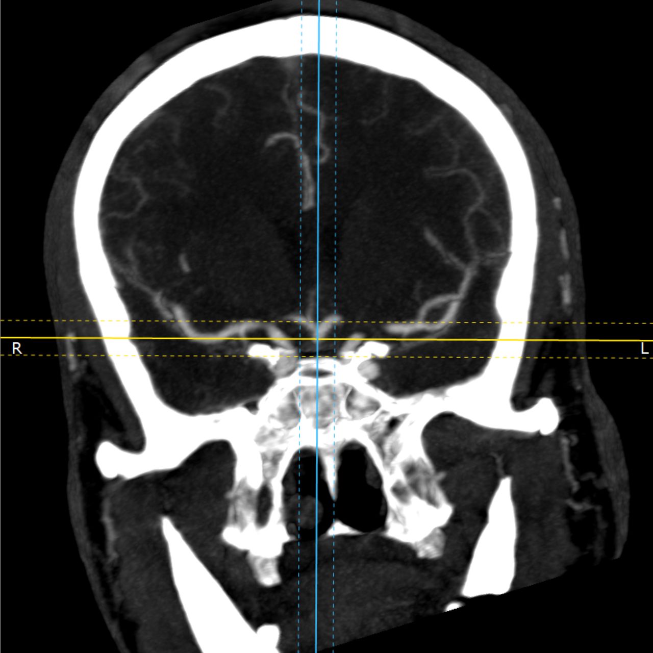 David Tafur Muñoz-1701