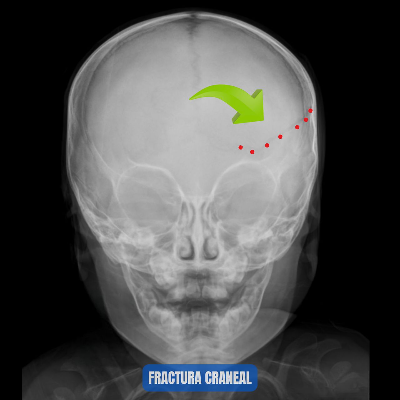 David Tafur Muñoz-1884